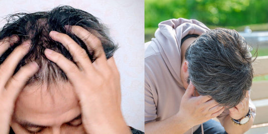 AGAとEDは同時に起こりやすい？男性ホルモンと加齢の深い関係