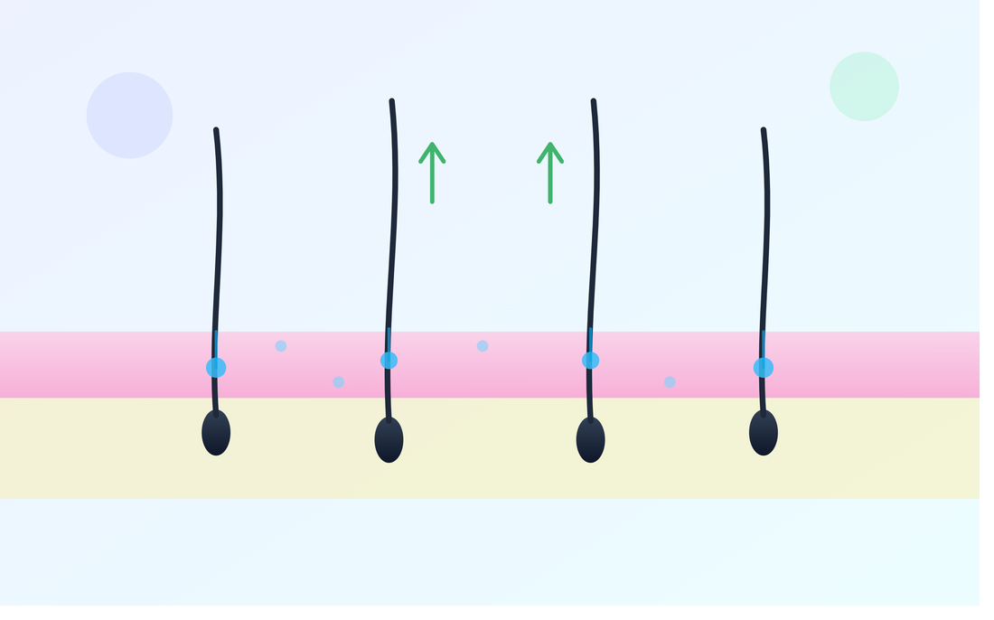 薄毛治療におけるメソセラピーとは？仕組み・成分・効果・副作用・他治療との比較を解説
