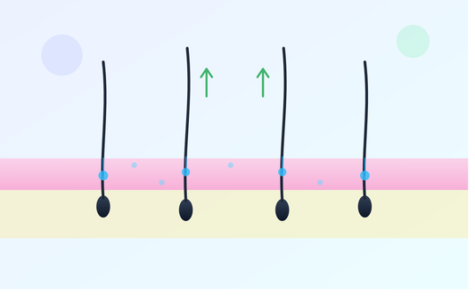 薄毛治療におけるメソセラピーとは？仕組み・成分・効果・副作用・他治療との比較を解説